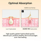 Gold Star Pimple & Acne Patches