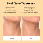Lifting Neck Wrinkle Patches